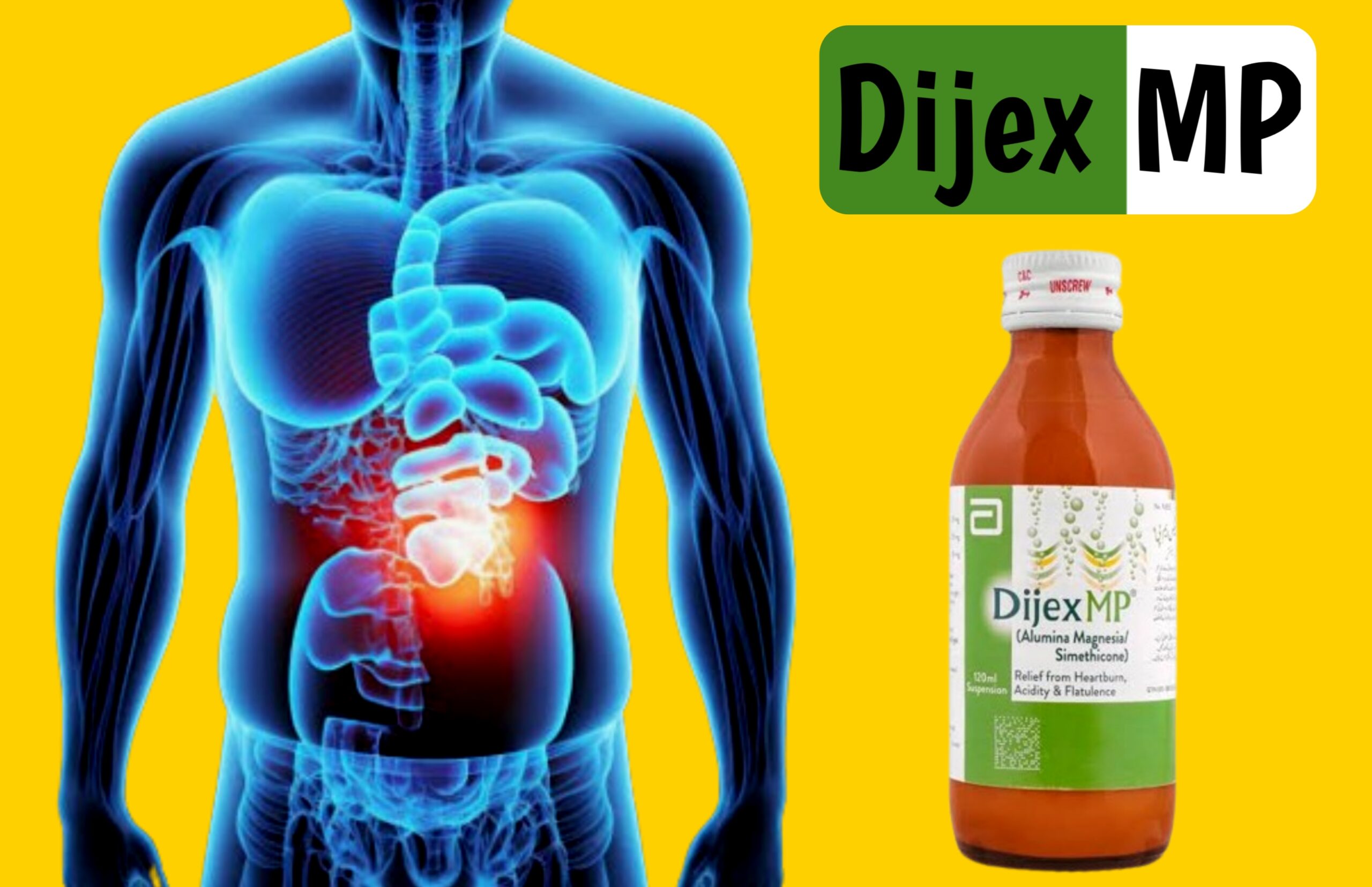 Dijex MP Syrup