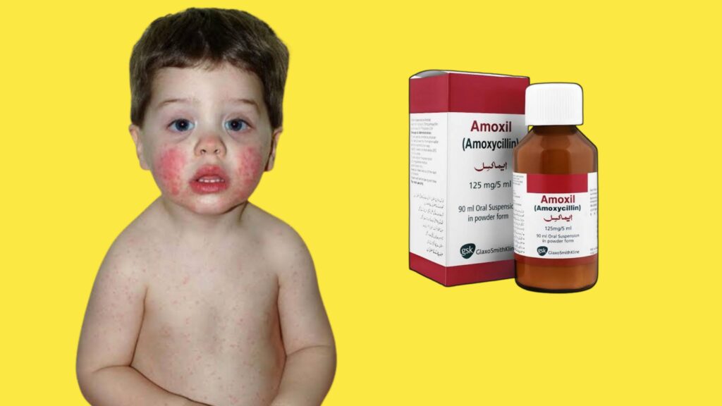 Amoxil Syrup