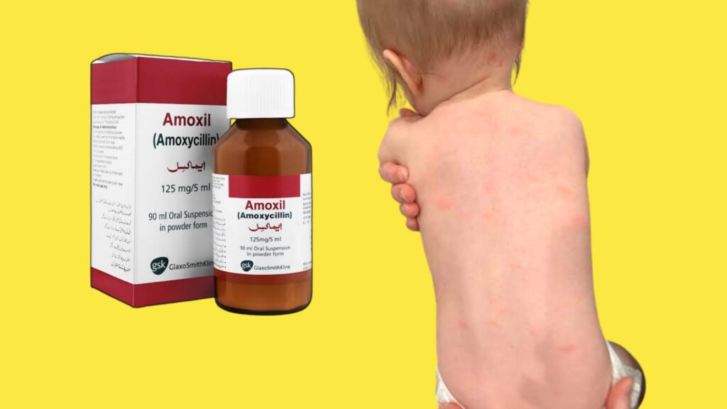 Amoxil Syrup