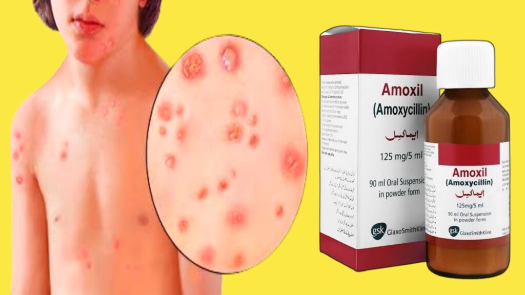 Amoxil Syrup